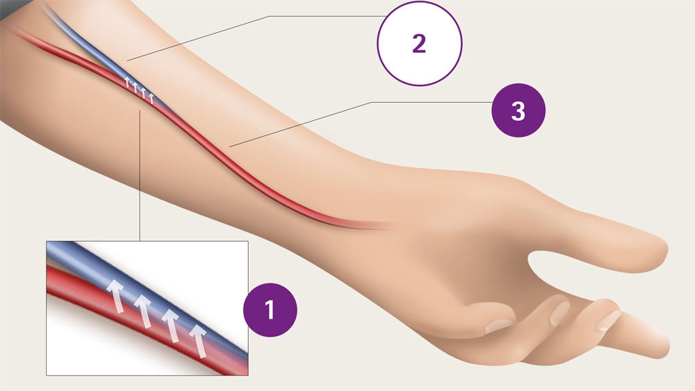 Diagram of arm blood vessels, clearly labeled to identify arteries, veins, and capillaries for educational purposes.