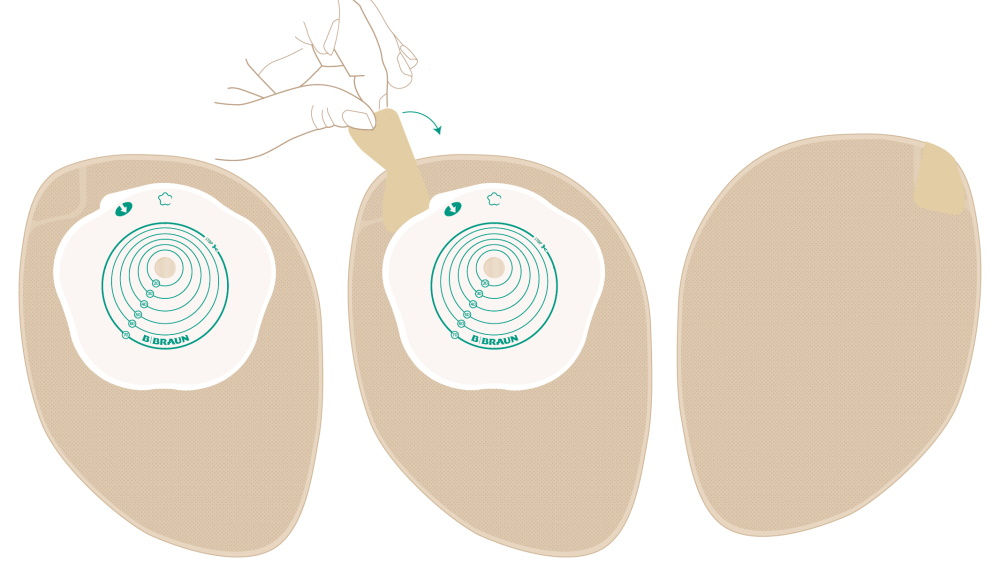 上部にコーナーフィルター付きバッグのデモ