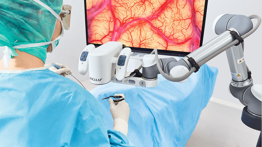 A surgeon performs a surgery with the Aesculap Aeos® while standing tall and looking at the monitor. 