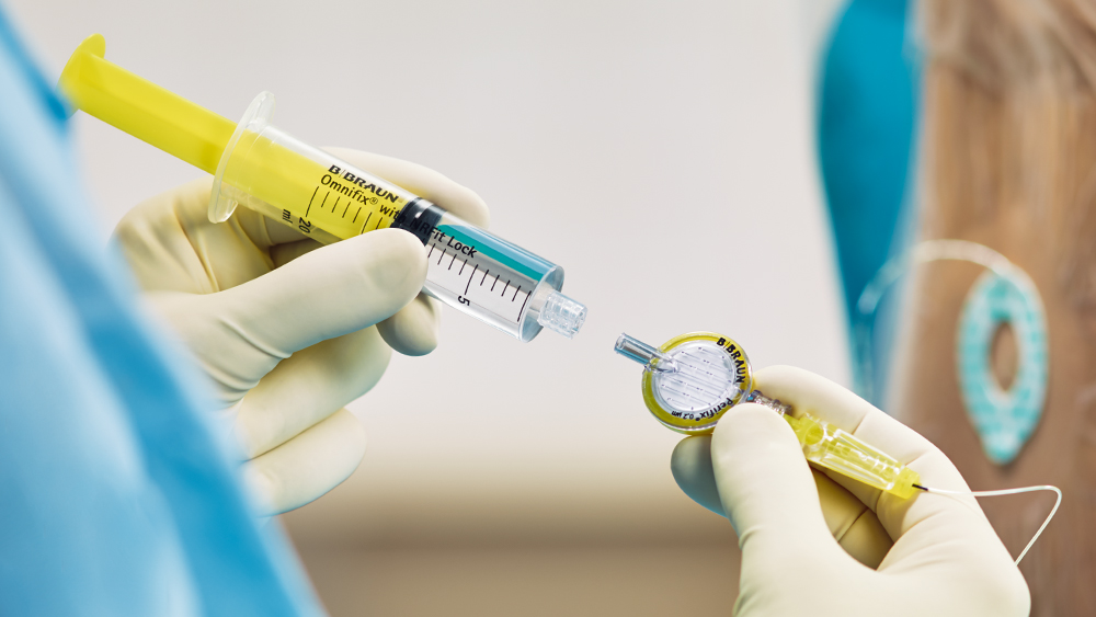 Eine mit Medikamenten gefüllte Spritze wird an einen Filter angeschlossen, der über einen speziellen Anschluss für die Regionalanästhesie verfügt.