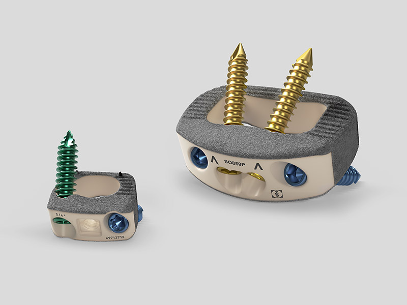 Plasmapore XP-beschichtete Wirbelkörperfusionsimplantate.