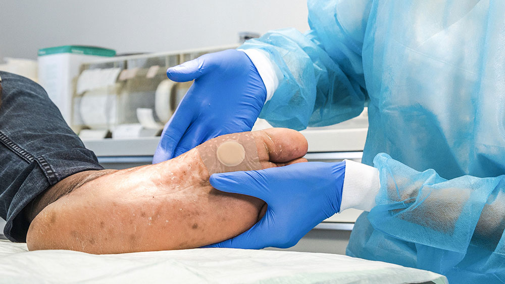 Zwei Hände mit Handschuhen halten einen diabetischen Fuß mit einem Pflaster auf, im Hintergrund medizinisches Material in einem Arztzimmer