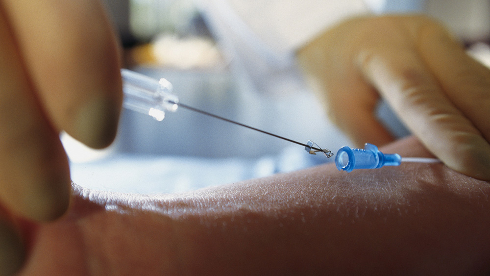 B. Braun kanülált fecskendő, közeli felvétel